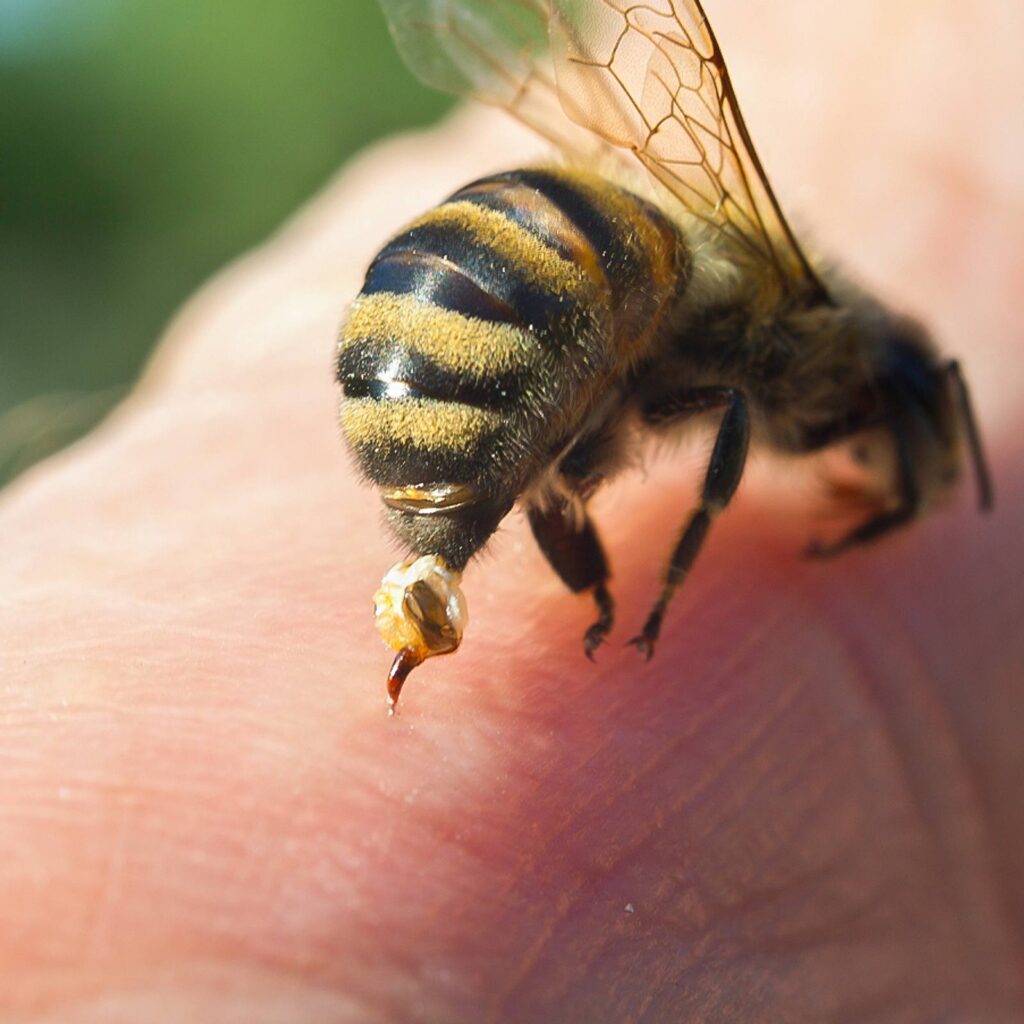 Biene die in der Hand sticht